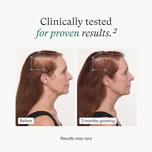 Nutrafol Women's Balance Hair Growth Supplements, 1-Month Supply